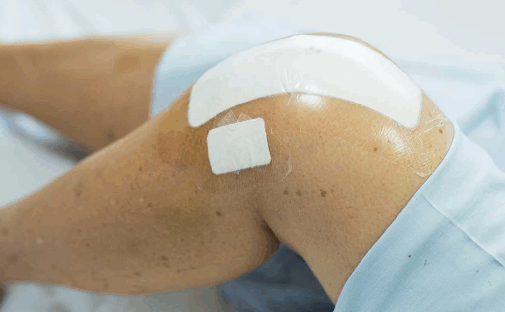 Les cicatrices après une reconstruction du LCA – à quoi s’attendre ?